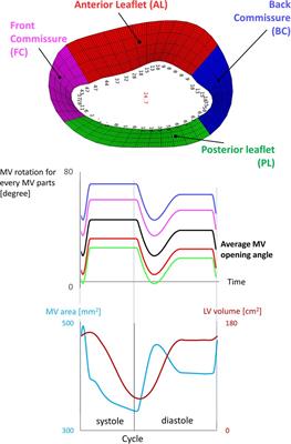 A CFD study on the interplay of torsion and vortex guidance by the mitral valve on the left ventricular wash-out making use of overset meshes (Chimera technique)